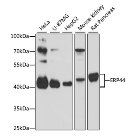 Western Blot - Anti-TXNDC4 Antibody (A87649) - Antibodies.com