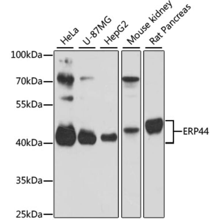 Western Blot - Anti-TXNDC4 Antibody (A87649) - Antibodies.com