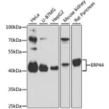 Western Blot - Anti-TXNDC4 Antibody (A87649) - Antibodies.com