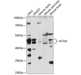 Western Blot - Anti-ACTL8 Antibody (A87650) - Antibodies.com