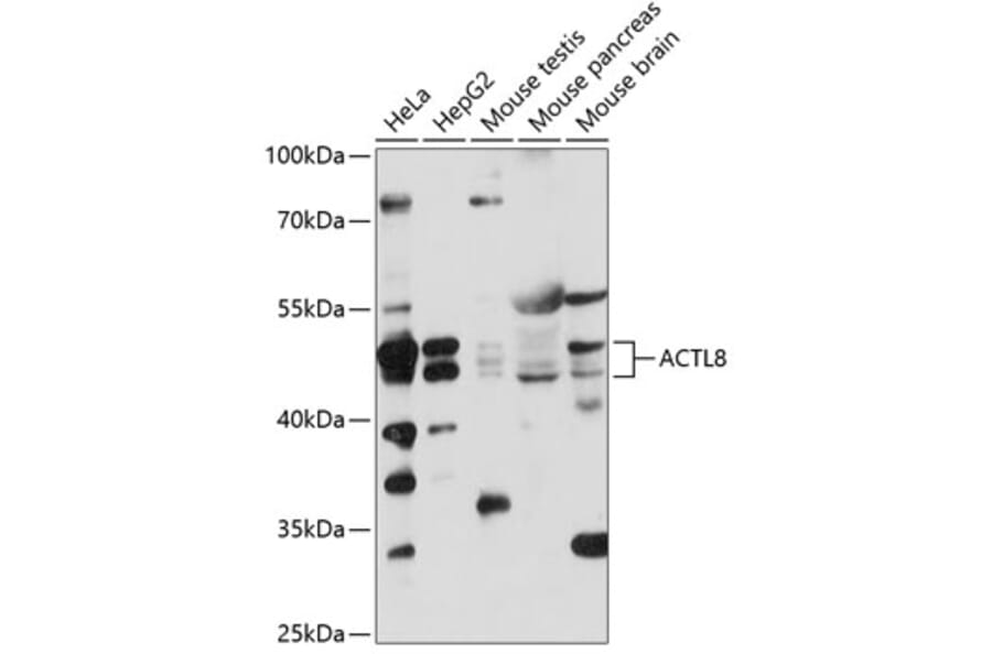 Western Blot - Anti-ACTL8 Antibody (A87650) - Antibodies.com