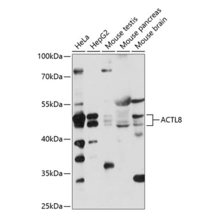 Western Blot - Anti-ACTL8 Antibody (A87650) - Antibodies.com
