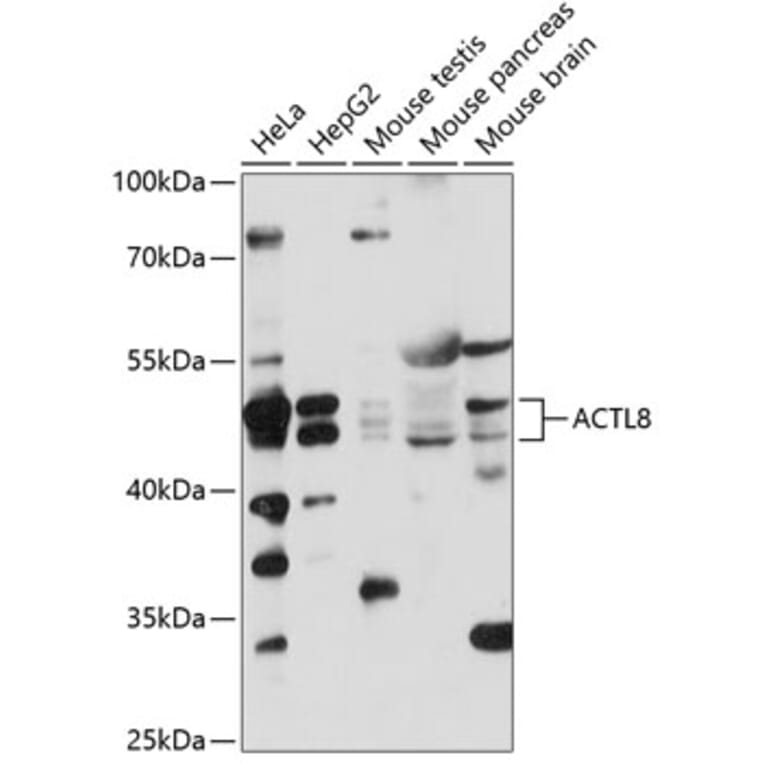 Western Blot - Anti-ACTL8 Antibody (A87650) - Antibodies.com