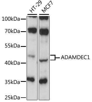 Western blot analysis of extracts of various cell lines, using Anti-ADAMDEC1 Antibody (A15435) at 1:1,000 dilution.
Secondary antibody: Goat Anti-Rabbit IgG (H+L) (HRP) (AS014) at 1:10,000 dilution.
Lysates / proteins: 25µg per lane.
Blocking buffer: 3% non-fat dry milk in TBST.
Detection: ECL Basic Kit (RM00020).
Exposure time: 30s.