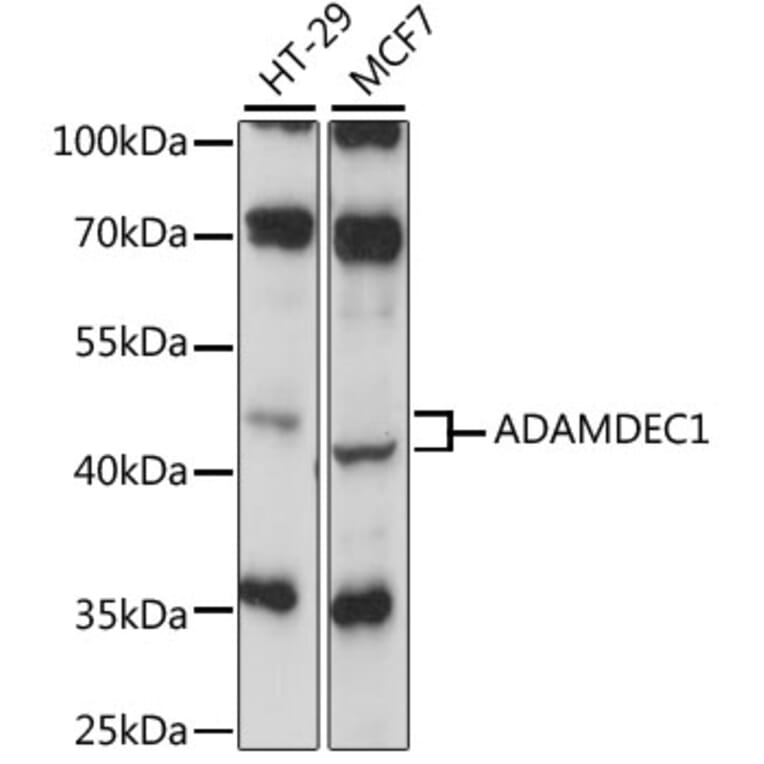 Western Blot - Anti-ADAMDEC1 Antibody (A87651) - Antibodies.com