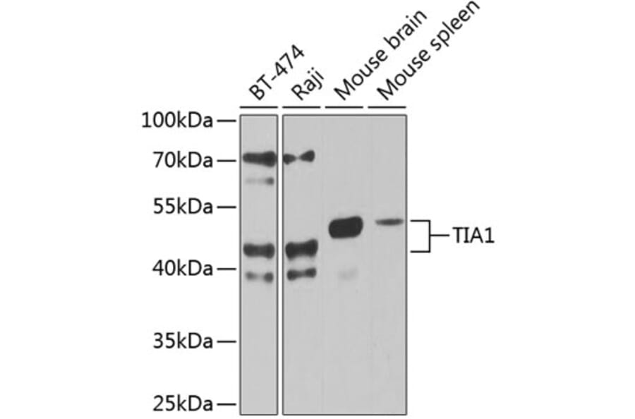 Western Blot - Anti-TIA1 Antibody (A87652) - Antibodies.com