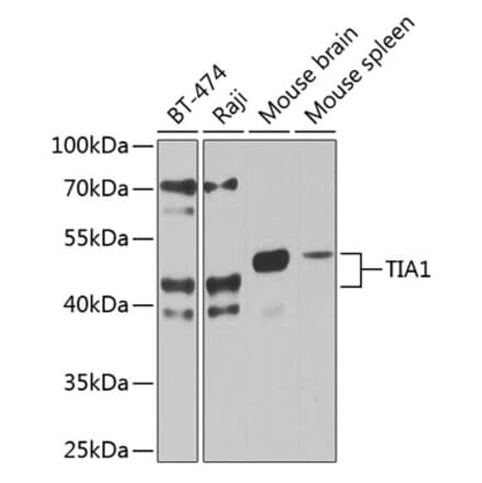 Western Blot - Anti-TIA1 Antibody (A87652) - Antibodies.com