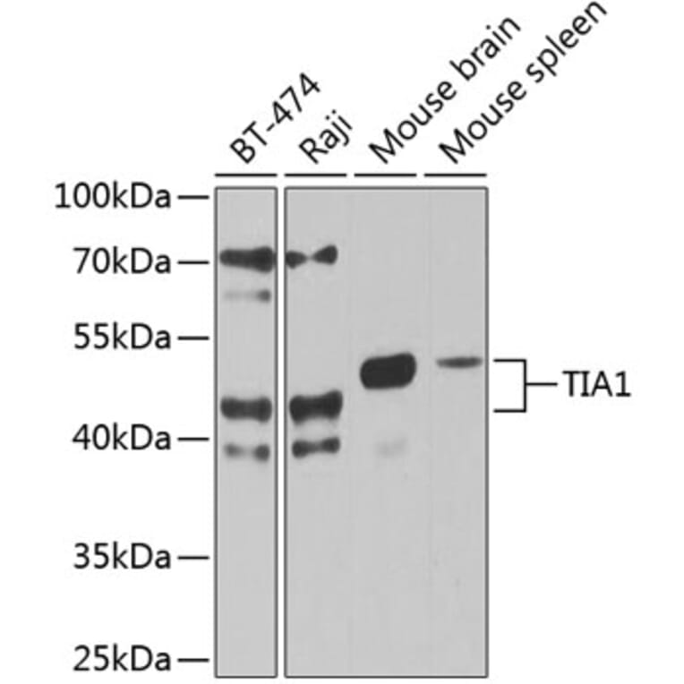 Western Blot - Anti-TIA1 Antibody (A87652) - Antibodies.com