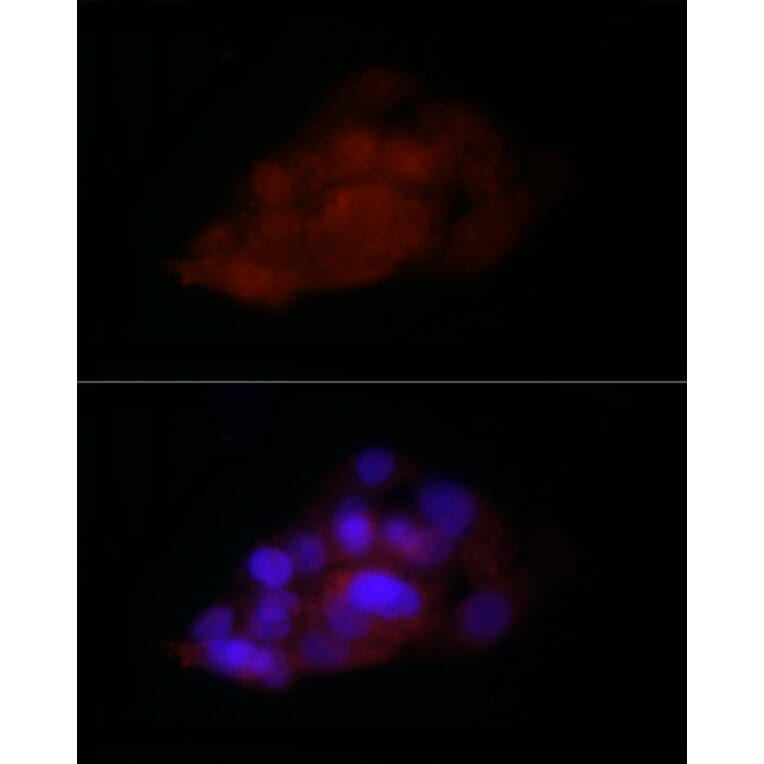 Immunofluorescence - Anti-TIA1 Antibody (A87652) - Antibodies.com