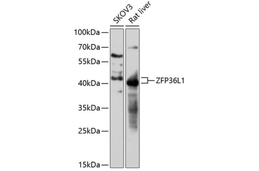 Western Blot - Anti-ZFP36L1 Antibody (A87653) - Antibodies.com