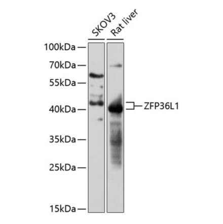 Western Blot - Anti-ZFP36L1 Antibody (A87653) - Antibodies.com