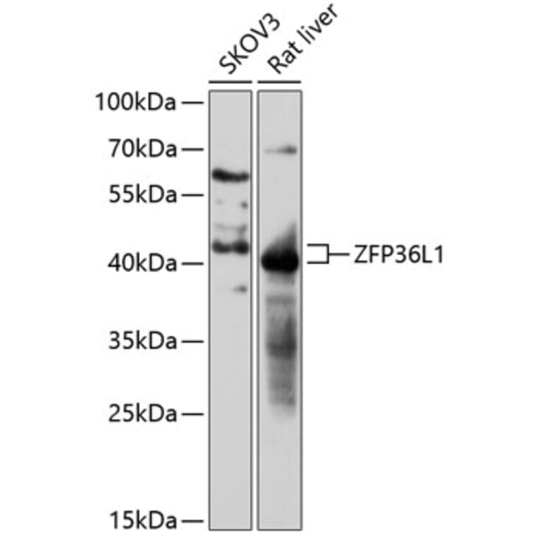 Western Blot - Anti-ZFP36L1 Antibody (A87653) - Antibodies.com