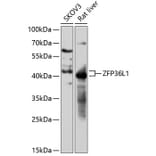 Western Blot - Anti-ZFP36L1 Antibody (A87653) - Antibodies.com