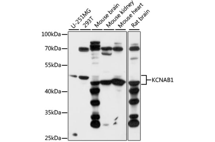 Western Blot - Anti-Kv beta 1/KCNAB1 Antibody (A87654) - Antibodies.com