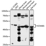 Western Blot - Anti-Kv beta 1/KCNAB1 Antibody (A87654) - Antibodies.com