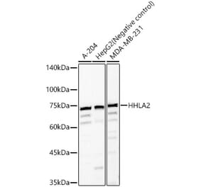 Western Blot - Anti-HHLA2 Antibody (A87655) - Antibodies.com