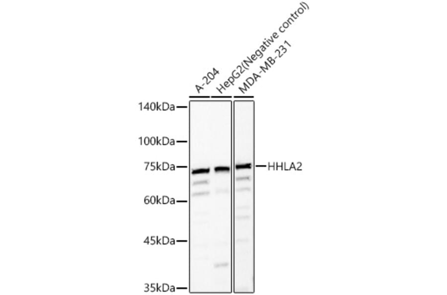 Western Blot - Anti-HHLA2 Antibody (A87655) - Antibodies.com