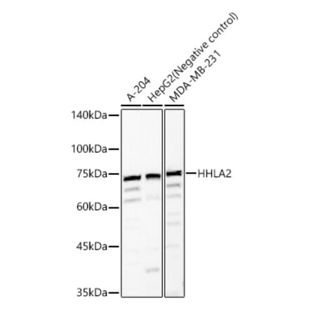 Western Blot - Anti-HHLA2 Antibody (A87655) - Antibodies.com