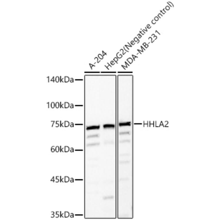 Western Blot - Anti-HHLA2 Antibody (A87655) - Antibodies.com