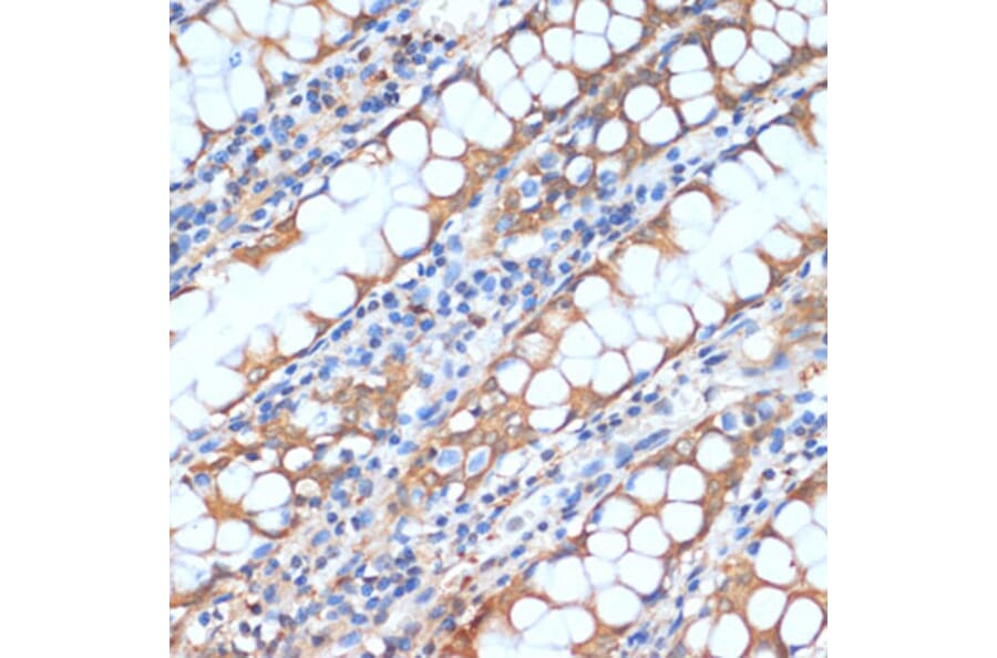 Immunohistochemistry - Anti-HHLA2 Antibody (A87655) - Antibodies.com
