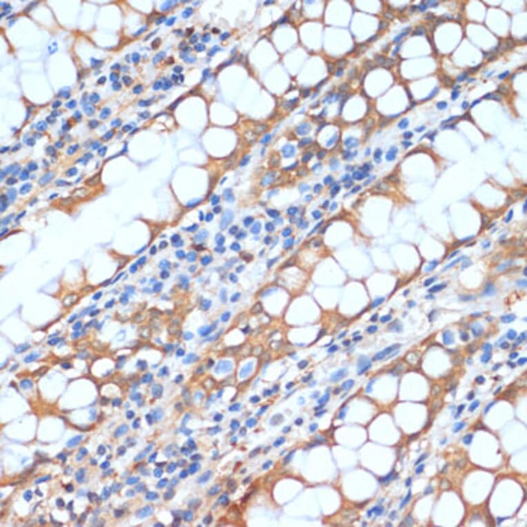 Immunohistochemistry - Anti-HHLA2 Antibody (A87655) - Antibodies.com