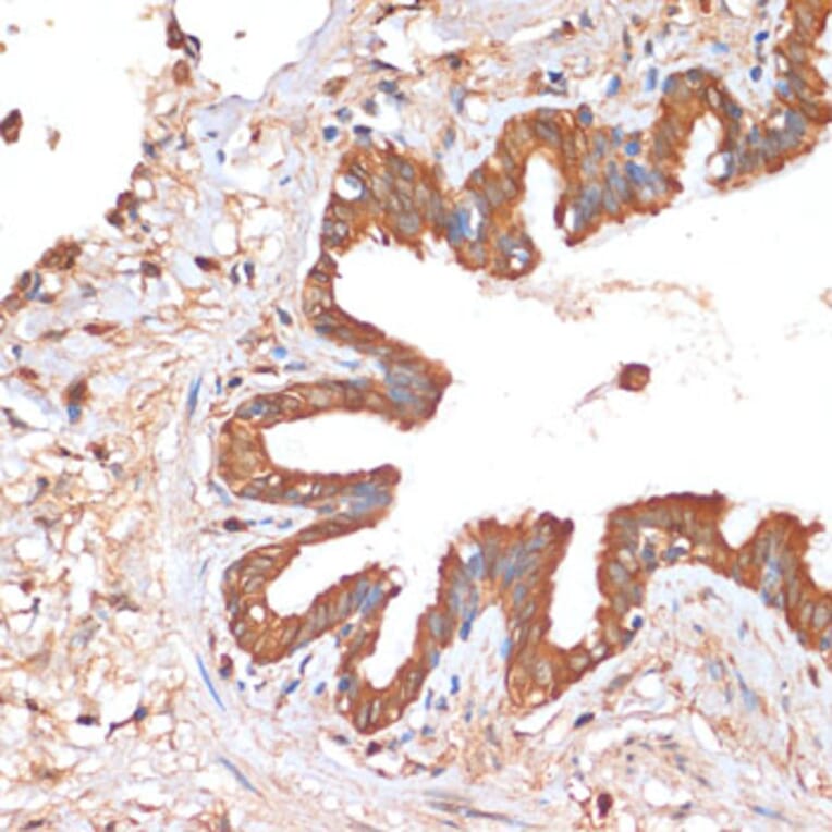Immunohistochemistry - Anti-HHLA2 Antibody (A87655) - Antibodies.com