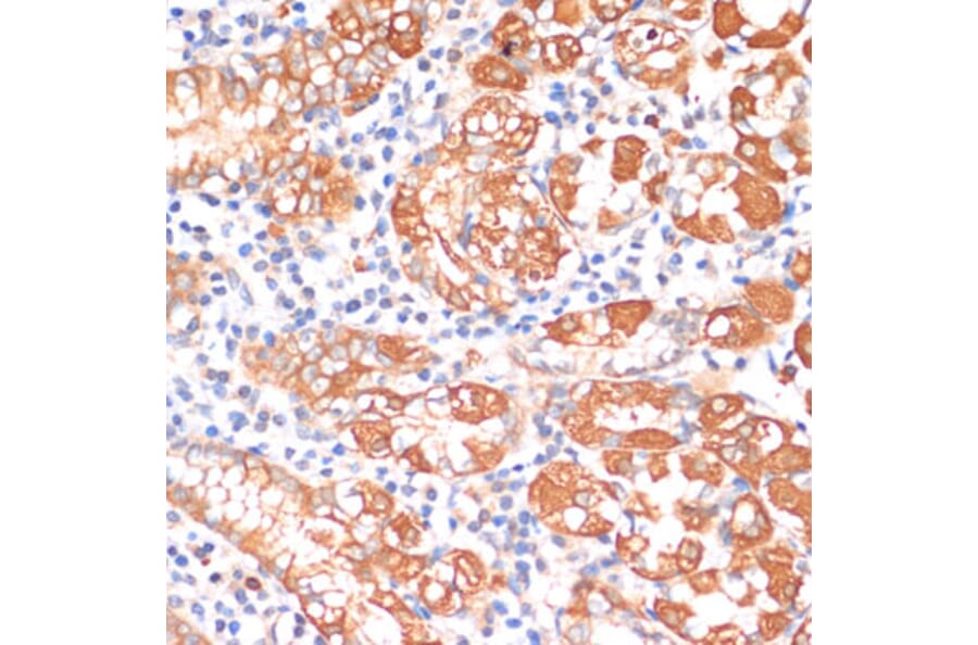Immunohistochemistry - Anti-HHLA2 Antibody (A87655) - Antibodies.com