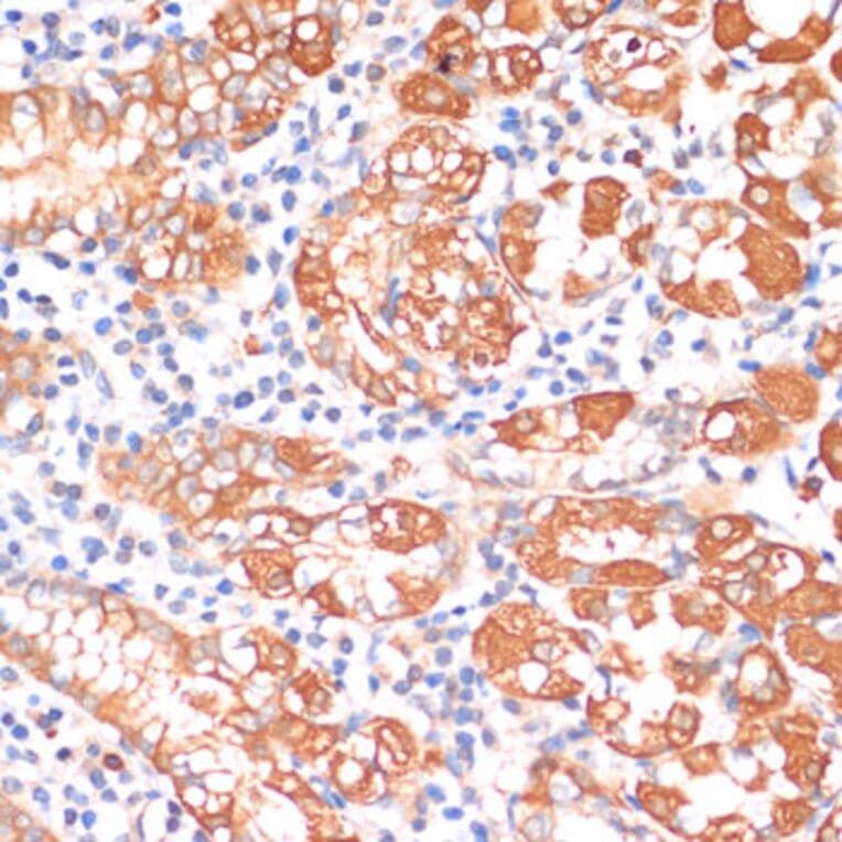 Immunohistochemistry - Anti-HHLA2 Antibody (A87655) - Antibodies.com