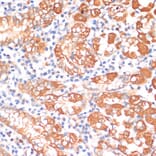 Immunohistochemistry - Anti-HHLA2 Antibody (A87655) - Antibodies.com