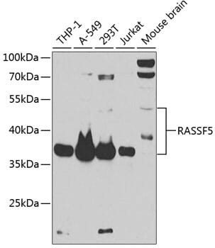 Western blot analysis of extracts of various cell lines, using Anti-RASSF5 Antibody (A12602) at 1:1,000 dilution.
Secondary antibody: Goat Anti-Rabbit IgG (H+L) (HRP) (AS014) at 1:10,000 dilution.
Lysates / proteins: 25µg per lane.
Blocking buffer: 3% non-fat dry milk in TBST.
Detection: ECL Basic Kit (RM00020).
Exposure time: 30s.