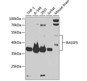 Western Blot - Anti-RASSF5 Antibody (A87656) - Antibodies.com