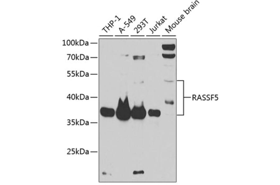 Western Blot - Anti-RASSF5 Antibody (A87656) - Antibodies.com