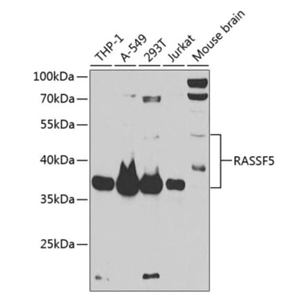 Western Blot - Anti-RASSF5 Antibody (A87656) - Antibodies.com