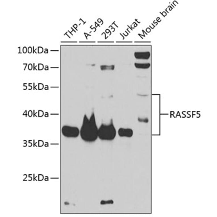 Western Blot - Anti-RASSF5 Antibody (A87656) - Antibodies.com