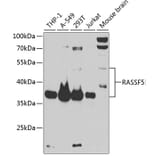 Western Blot - Anti-RASSF5 Antibody (A87656) - Antibodies.com