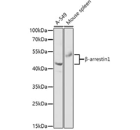 Western Blot - Anti-beta Arrestin 1 Antibody (A87657) - Antibodies.com
