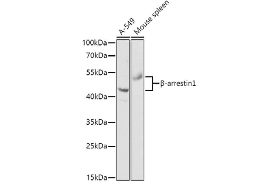 Western Blot - Anti-beta Arrestin 1 Antibody (A87657) - Antibodies.com