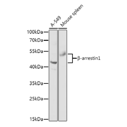 Western Blot - Anti-beta Arrestin 1 Antibody (A87657) - Antibodies.com