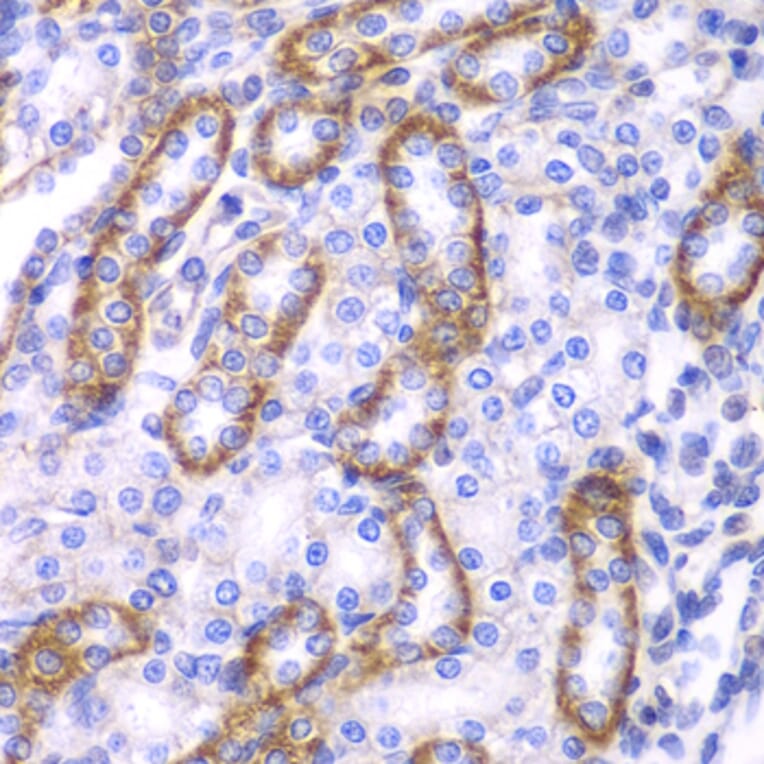 Immunohistochemistry - Anti-beta Arrestin 1 Antibody (A87657) - Antibodies.com