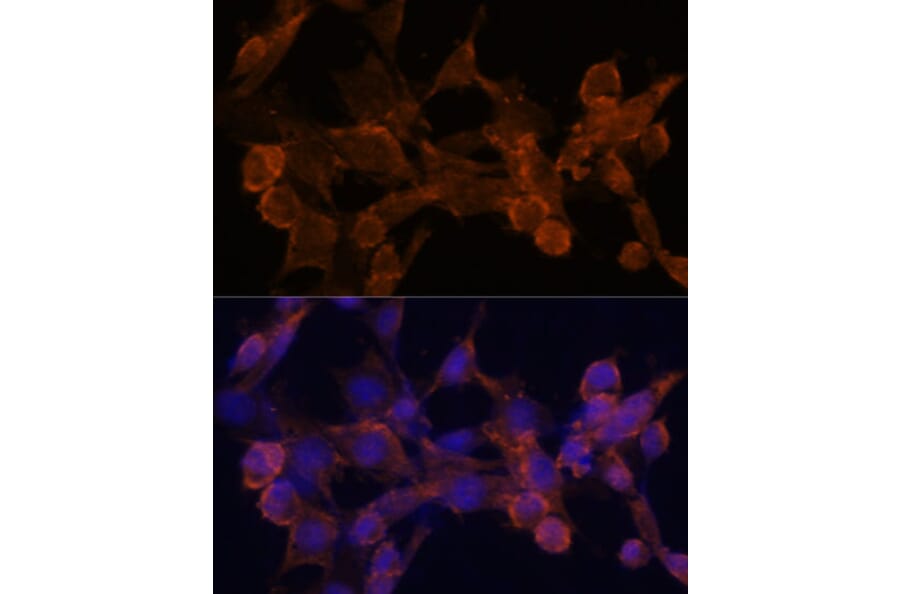 Immunofluorescence - Anti-beta Arrestin 1 Antibody (A87657) - Antibodies.com