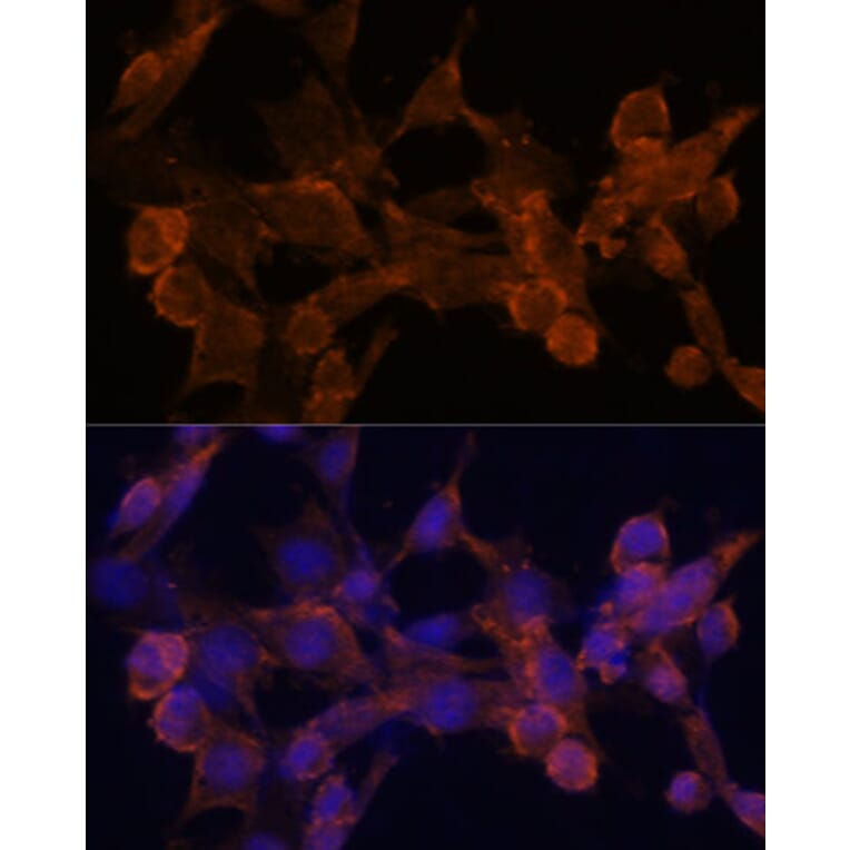 Immunofluorescence - Anti-beta Arrestin 1 Antibody (A87657) - Antibodies.com