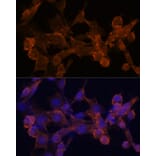 Immunofluorescence - Anti-beta Arrestin 1 Antibody (A87657) - Antibodies.com