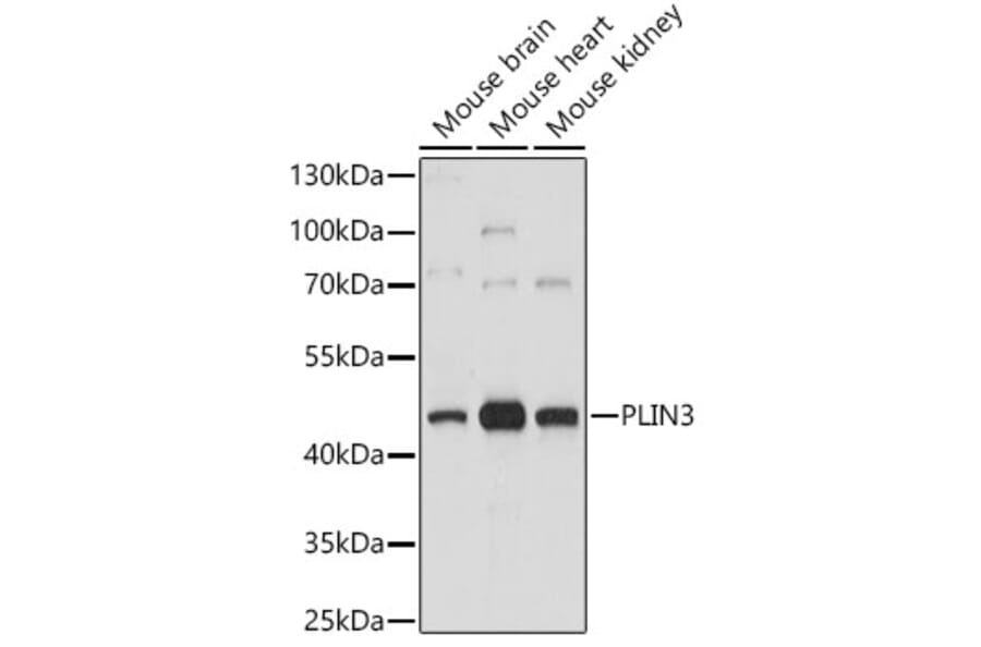 Western Blot - Anti-Perilipin 3/TIP47 Antibody (A87658) - Antibodies.com