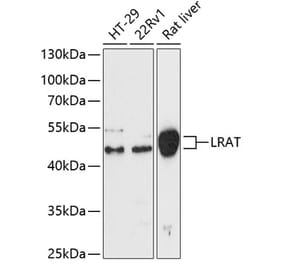 Western Blot - Anti-LRAT Antibody (A87659) - Antibodies.com