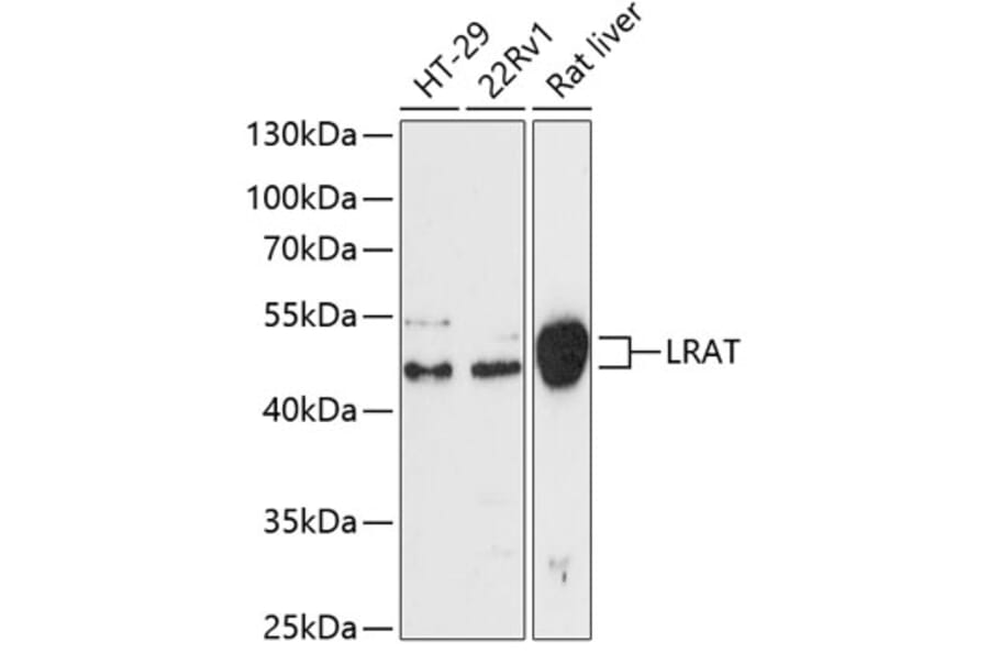 Western Blot - Anti-LRAT Antibody (A87659) - Antibodies.com