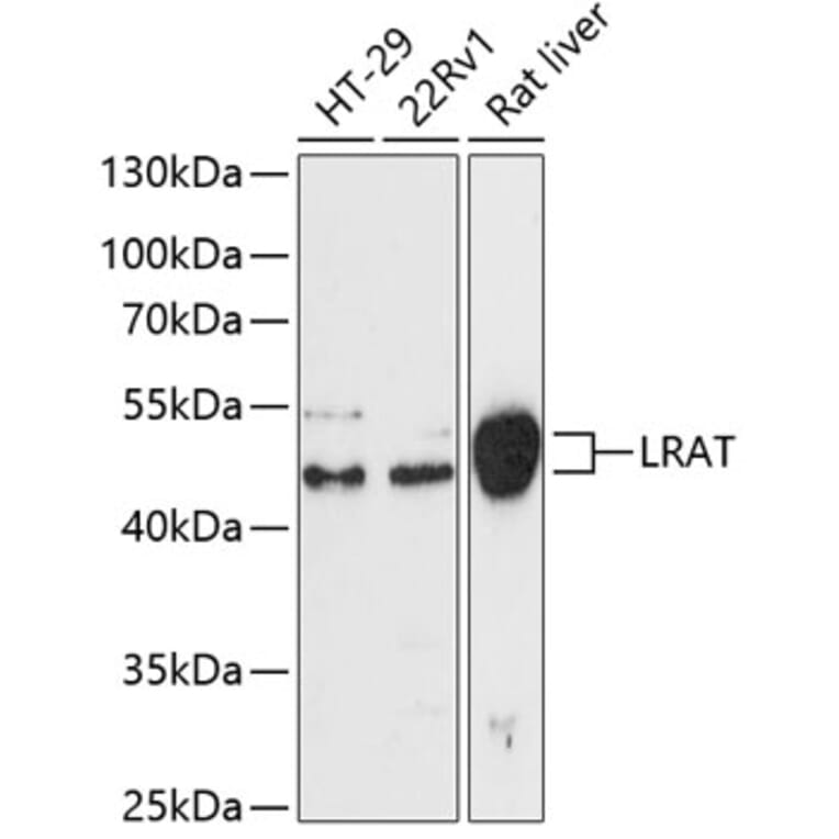 Western Blot - Anti-LRAT Antibody (A87659) - Antibodies.com