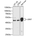 Western Blot - Anti-LRAT Antibody (A87659) - Antibodies.com