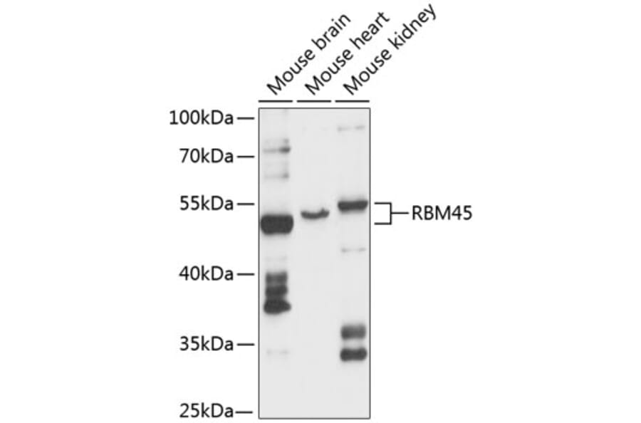 Western Blot - Anti-RB-1 Antibody (A87660) - Antibodies.com