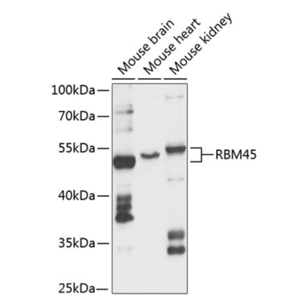 Western Blot - Anti-RB-1 Antibody (A87660) - Antibodies.com