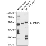 Western Blot - Anti-RB-1 Antibody (A87660) - Antibodies.com
